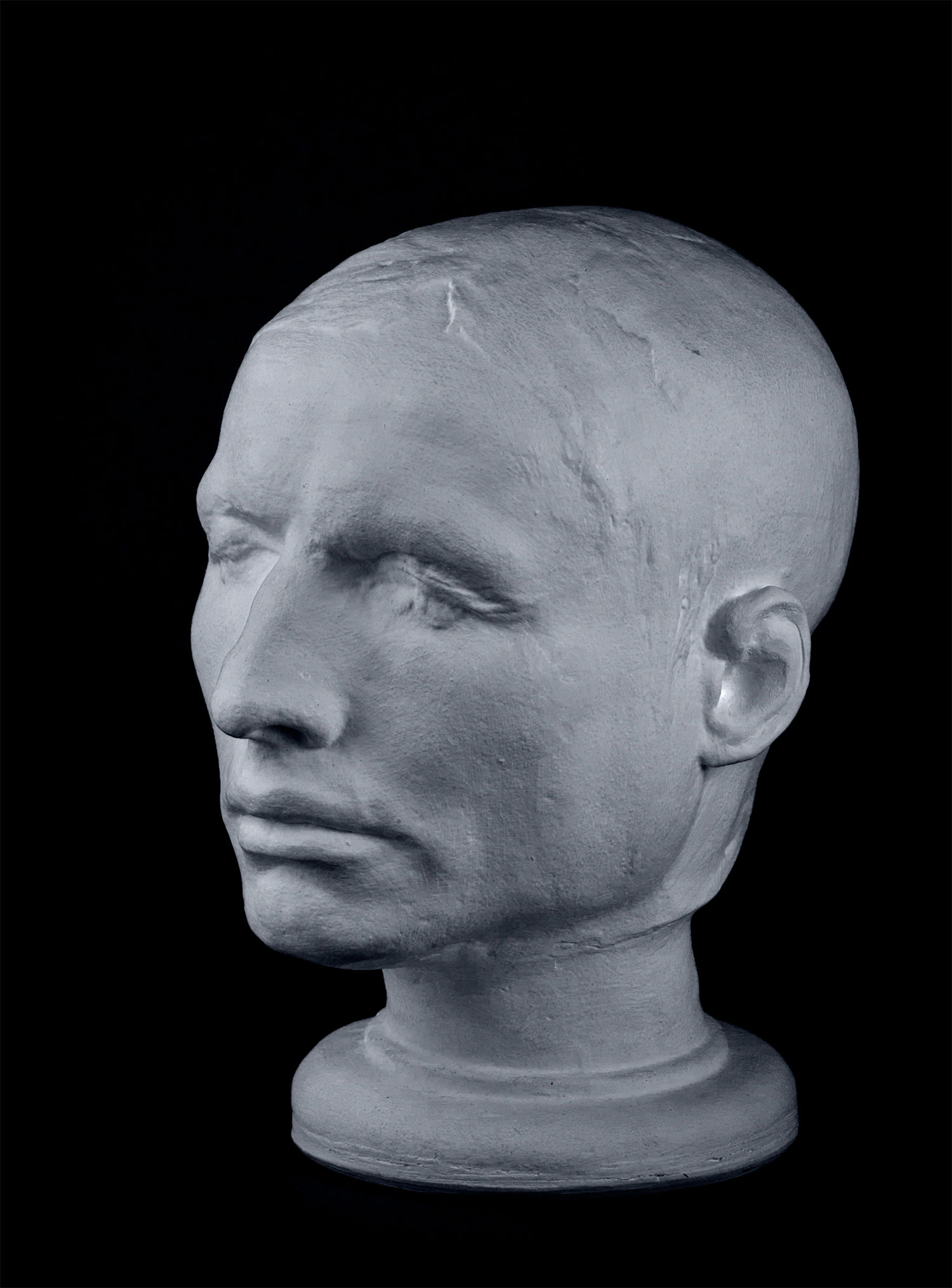 Life mask of Hare, on display in the Anatomical Museum at the University of Edinburgh. No-one is quite sure what happened to Hare after the trial. Rumours circulated that he had escaped to London, where he was thrown into a lime pit and blinded, but it is more likely that he returned to Ireland. © The Anatomical Museum at the University of Edinburgh.