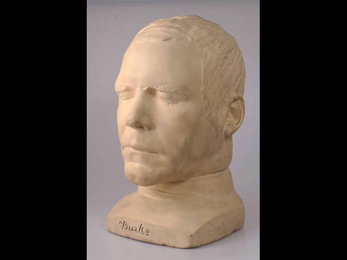Death mask of William Burke. The mark of the noose can be seen on the neck. © Surgeons’ Hall Museums at the Royal College of Surgeons of Edinburgh.