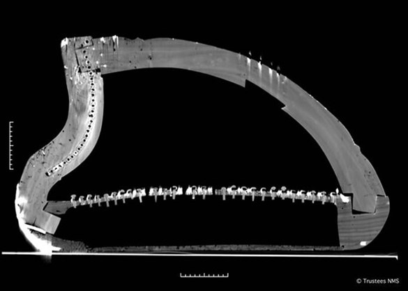 Queen Mary harp CT scan cross-section