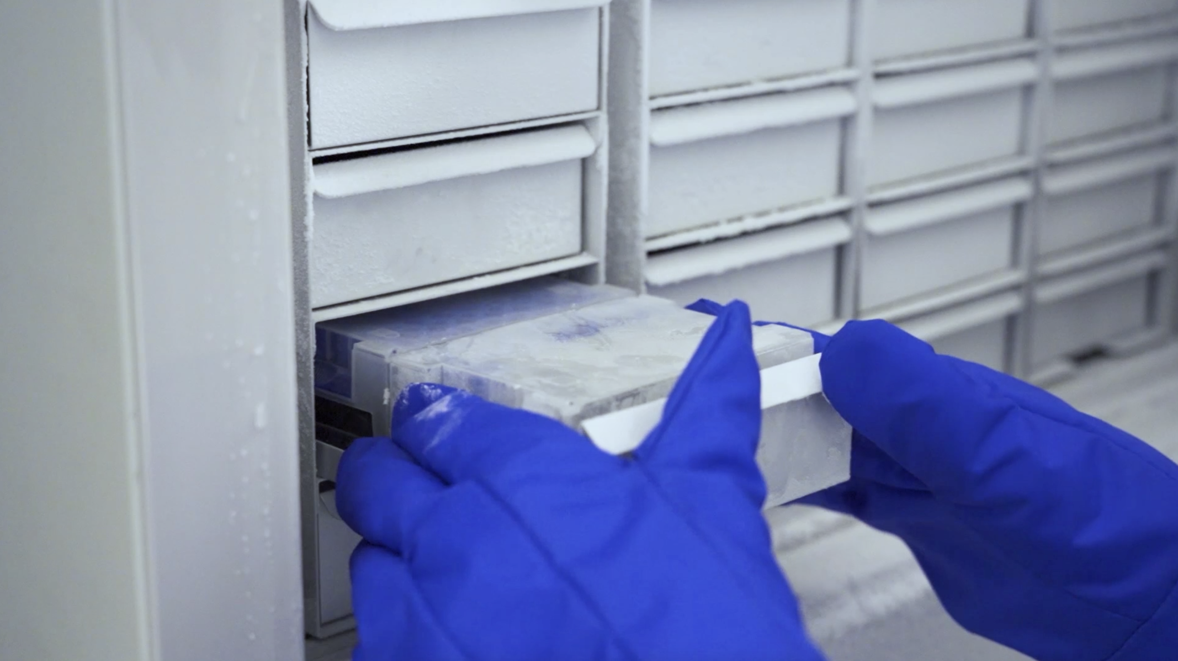 Our samples are stored away from light and kept at -80 degrees celsius. Each biobank freezer stores over 20,000 samples!