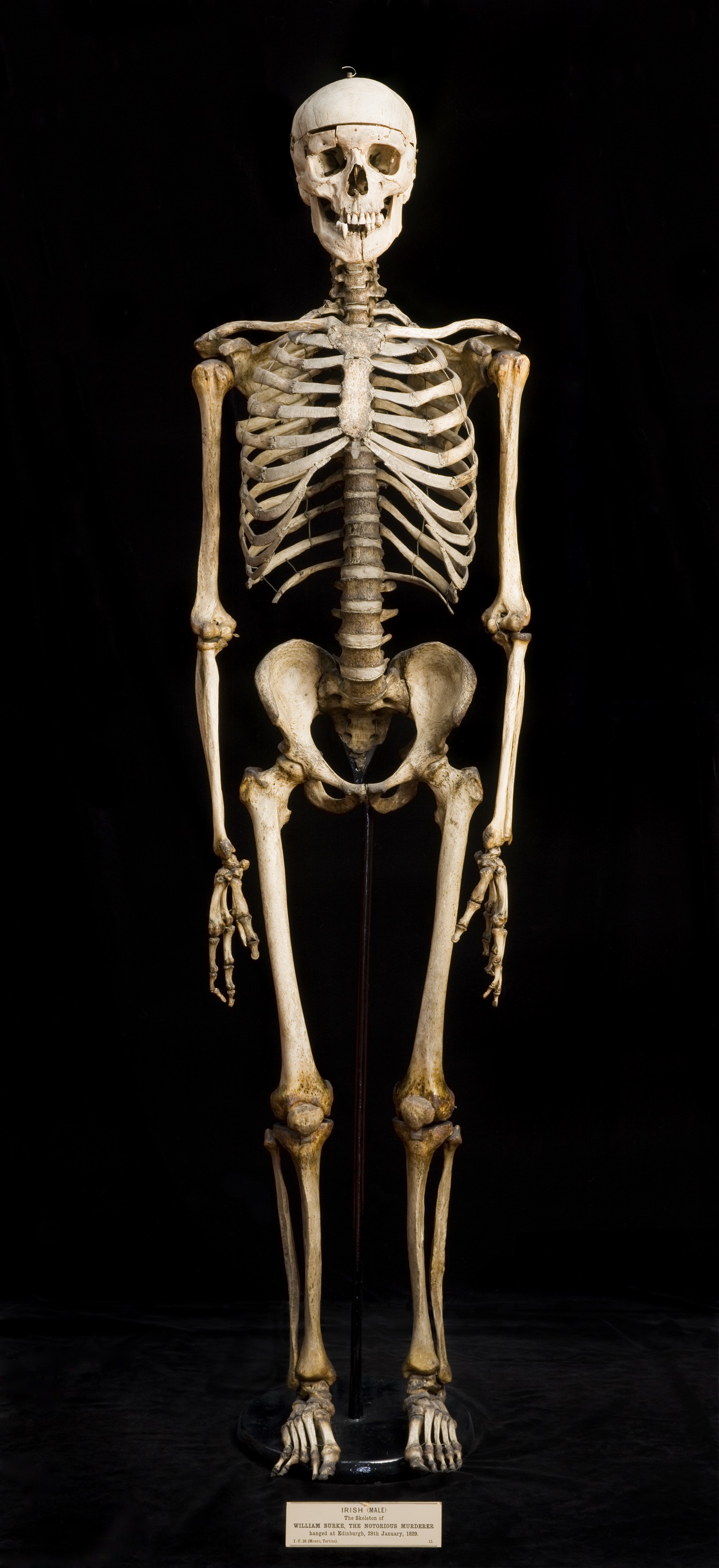 On the orders of the Lord Justice-Clerk, after dissection Burke’s skeleton was preserved, ‘in order that posterity may keep in remembrance of [his] atrocious crimes’. The skeleton can be seen in the Anatomical Museum at the University of Edinburgh. © The Anatomical Museum at the University of Edinburgh.