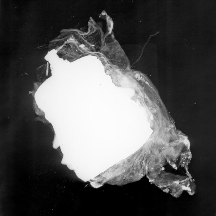 X-ray image highlighting the jar in bright grey-white, with the textile pouch appearing in translucent grey.