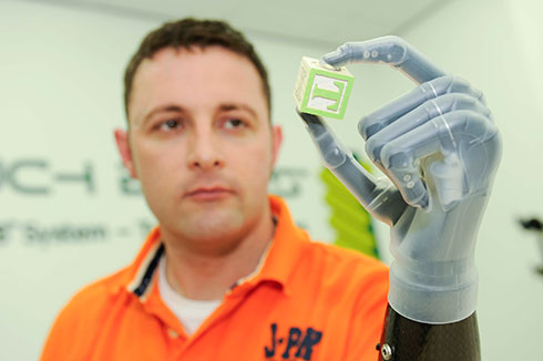 The i-limb ultra &copy; Touch Bionics